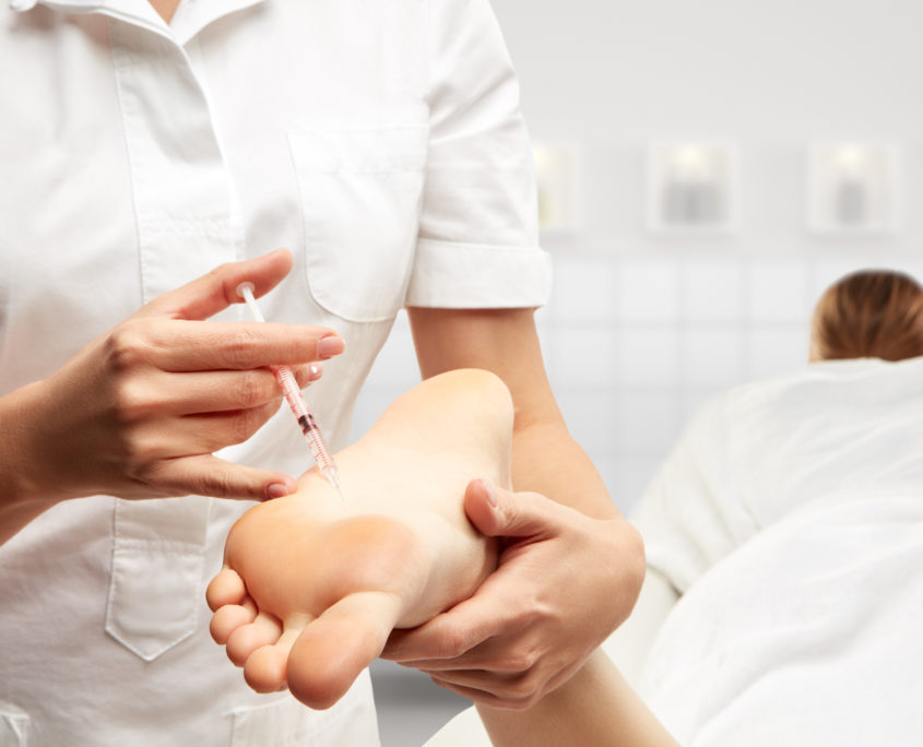 anti-transpiratie-botox-behandeling-voeten